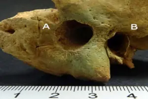 Perforaci&oacute;n de unos 12 mm de di&aacute;metro detr&aacute;s del orificio del o&iacute;do derecho. Universidad Aut&oacute;noma de Barcelona.