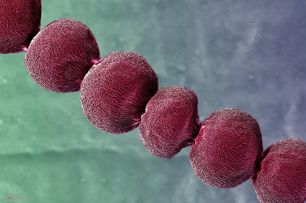 Fotograf&iacute;a seleccionada en la modalidad Micro de FOTCIENCIA20. / Concepci&oacute;n Hern&aacute;ndez Castillo