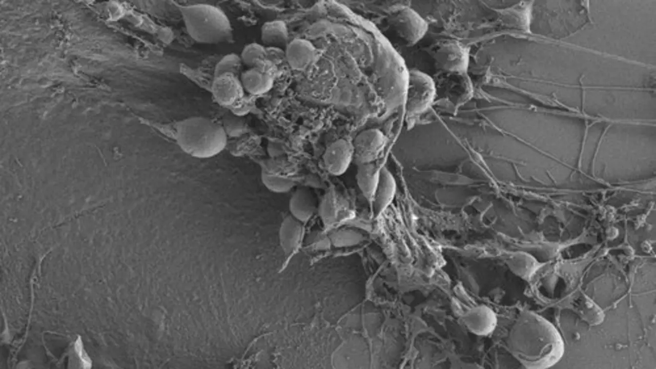 C&eacute;lula de glioblastoma humano | dicyt
